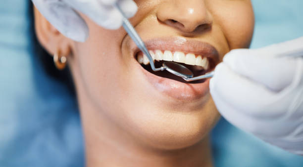 Best Emergency Treatment for Dental Infections or Abscesses in Fort Recovery, OH