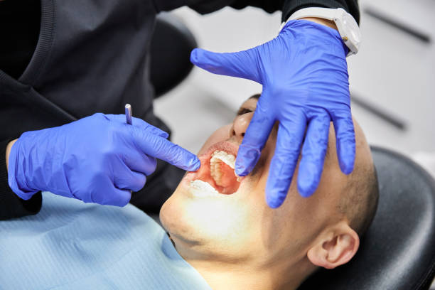 Best Urgent Care for Lost Fillings or Crowns in Fort Recovery, OH